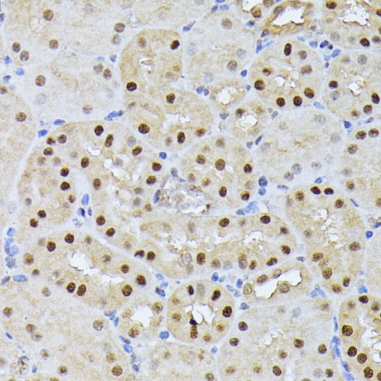 Immunohistochemistry - Anti-Ubiquitin Antibody (A91956) - Antibodies.com