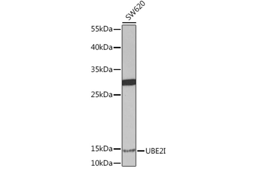 Western Blot - Anti-UBE2I / UBC9 Antibody (A91957) - Antibodies.com