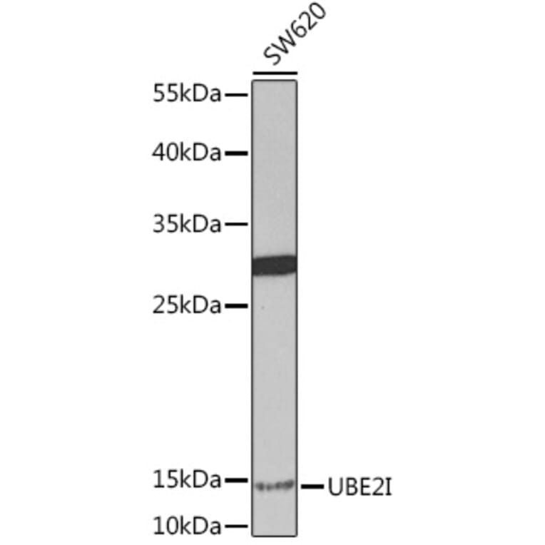 Western Blot - Anti-UBE2I / UBC9 Antibody (A91957) - Antibodies.com
