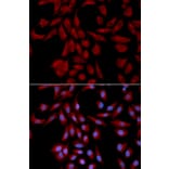 Immunofluorescence - Anti-UBE2I / UBC9 Antibody (A91957) - Antibodies.com