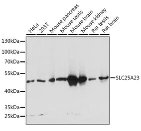 Western Blot - Anti-SLC25A23 Antibody (A91959) - Antibodies.com
