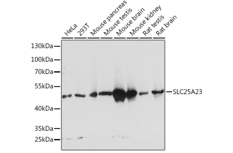 Western Blot - Anti-SLC25A23 Antibody (A91959) - Antibodies.com