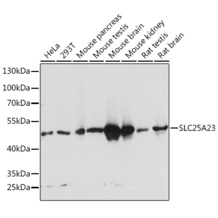 Western Blot - Anti-SLC25A23 Antibody (A91959) - Antibodies.com