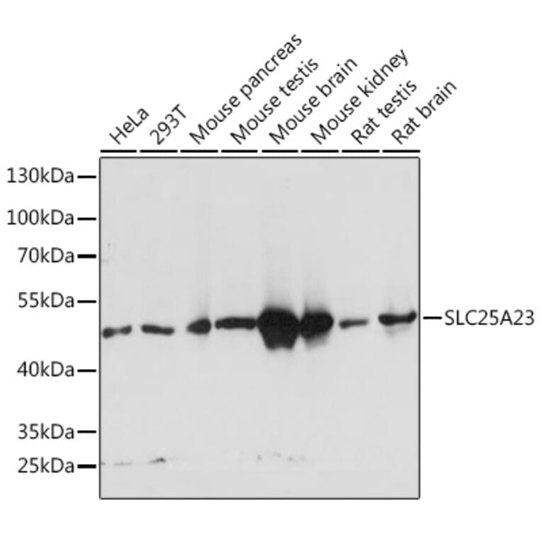 Western Blot - Anti-SLC25A23 Antibody (A91959) - Antibodies.com