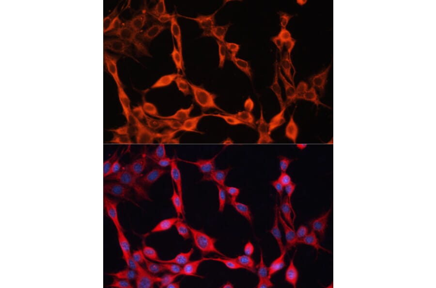 Immunofluorescence - Anti-SLC25A23 Antibody (A91959) - Antibodies.com