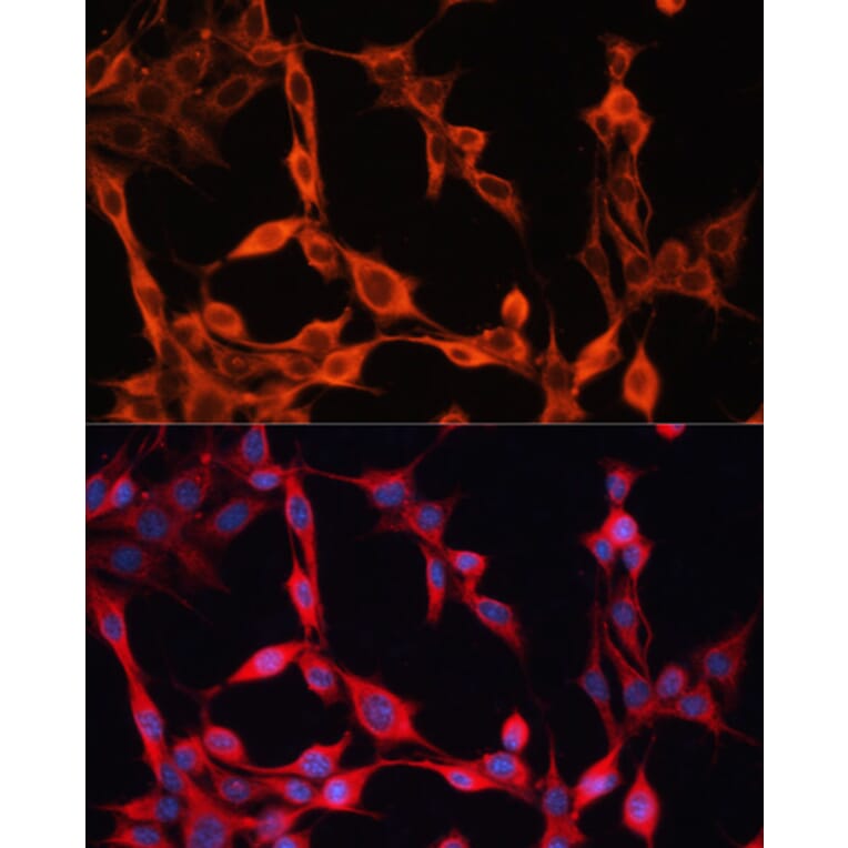 Immunofluorescence - Anti-SLC25A23 Antibody (A91959) - Antibodies.com