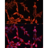Immunofluorescence - Anti-SLC25A23 Antibody (A91959) - Antibodies.com
