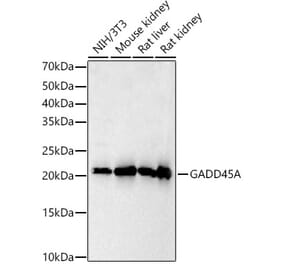 Western Blot - Anti-GADD45A Antibody (A91962) - Antibodies.com