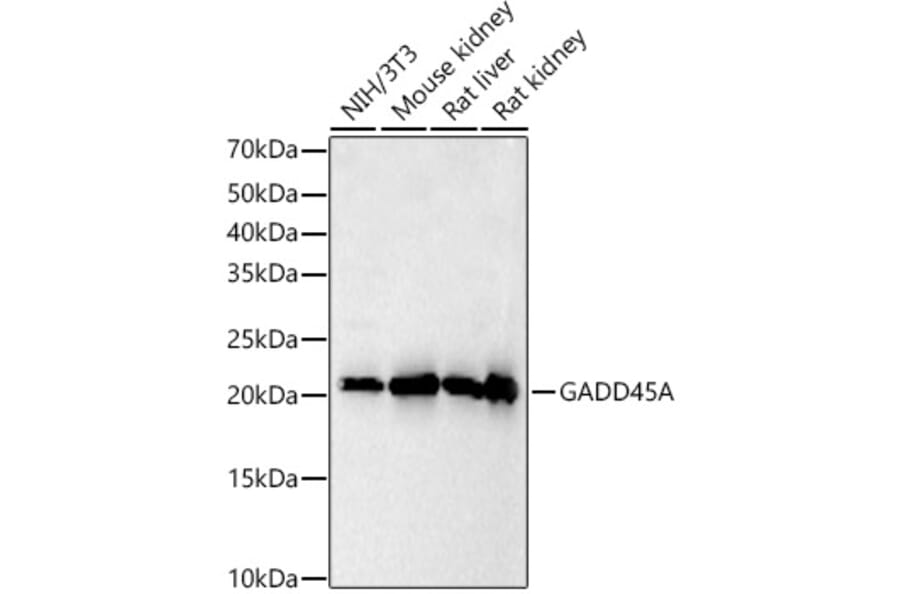 Western Blot - Anti-GADD45A Antibody (A91962) - Antibodies.com
