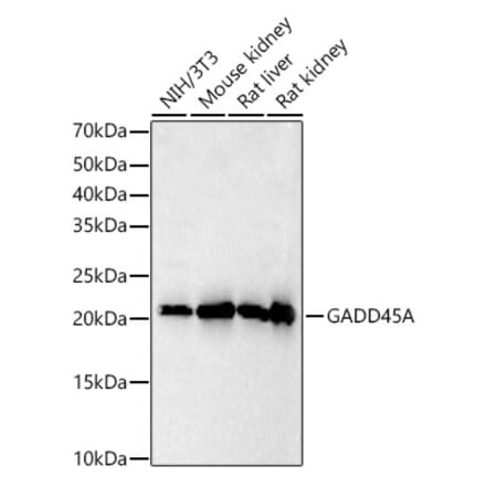 Western Blot - Anti-GADD45A Antibody (A91962) - Antibodies.com