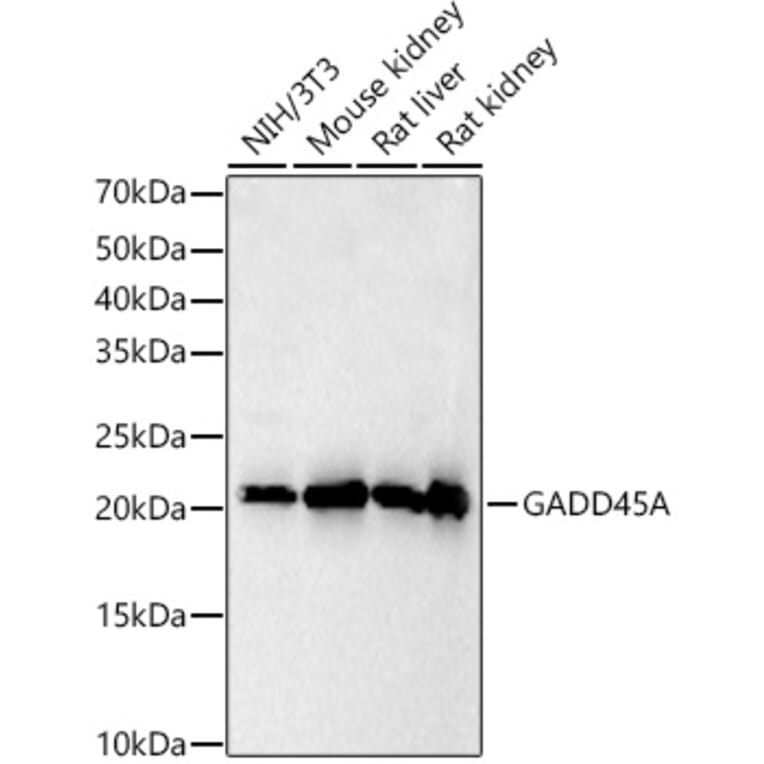 Western Blot - Anti-GADD45A Antibody (A91962) - Antibodies.com