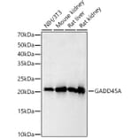 Western Blot - Anti-GADD45A Antibody (A91962) - Antibodies.com