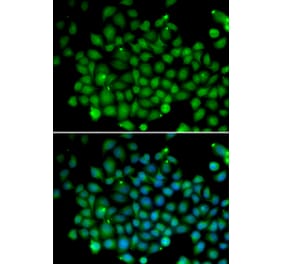 Immunofluorescence - Anti-FAT10 Antibody (A91963) - Antibodies.com