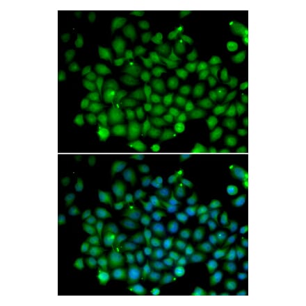 Immunofluorescence - Anti-FAT10 Antibody (A91963) - Antibodies.com