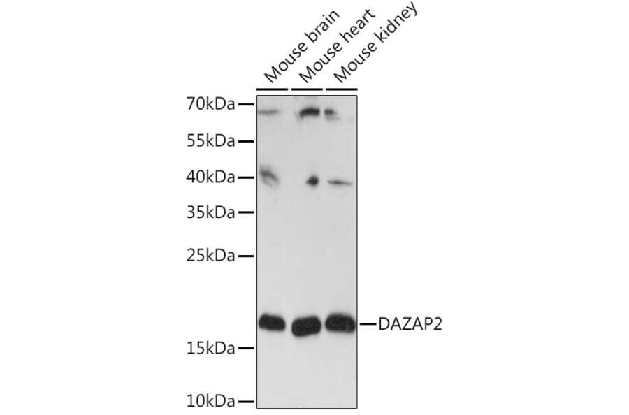 Western Blot - Anti-DAZAP2 Antibody (A91964) - Antibodies.com