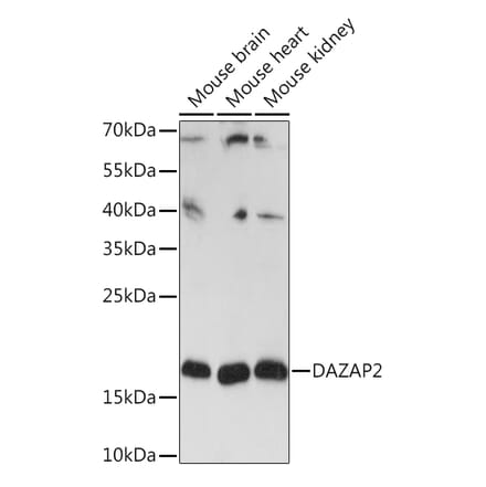 Western Blot - Anti-DAZAP2 Antibody (A91964) - Antibodies.com
