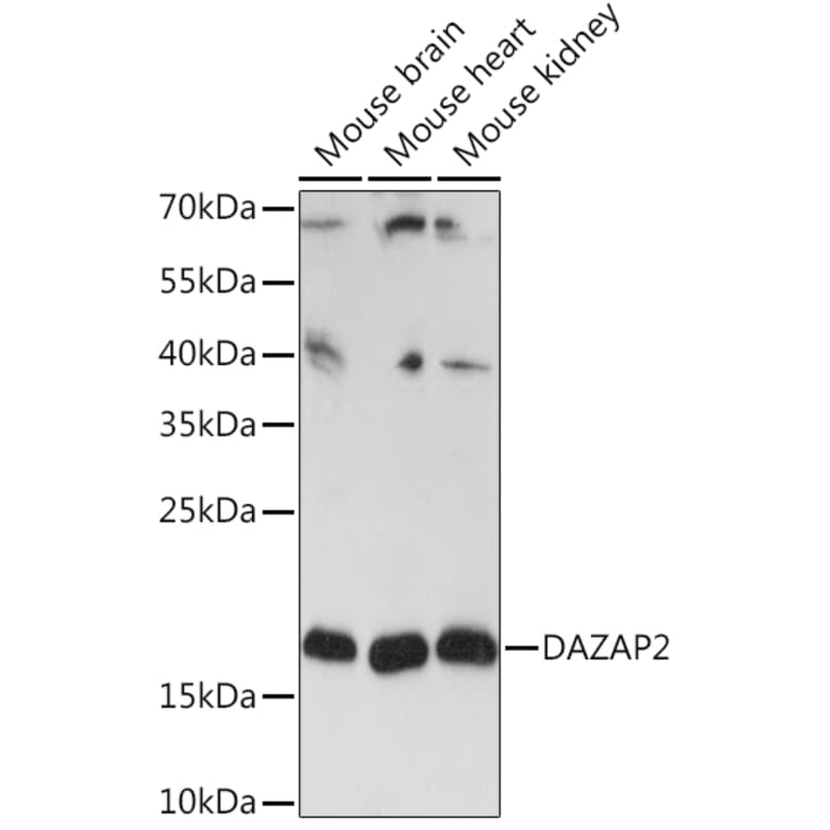 Western Blot - Anti-DAZAP2 Antibody (A91964) - Antibodies.com