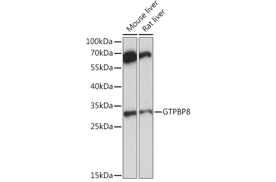 Western Blot - Anti-GTPBP8 Antibody (A91965) - Antibodies.com