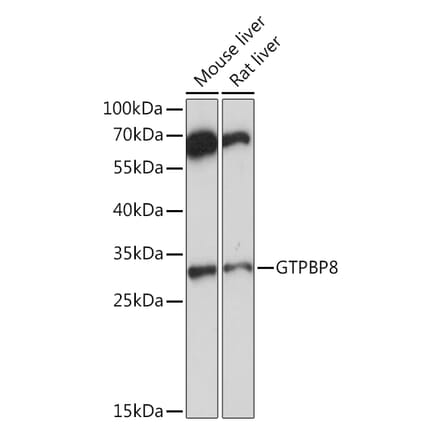 Western Blot - Anti-GTPBP8 Antibody (A91965) - Antibodies.com