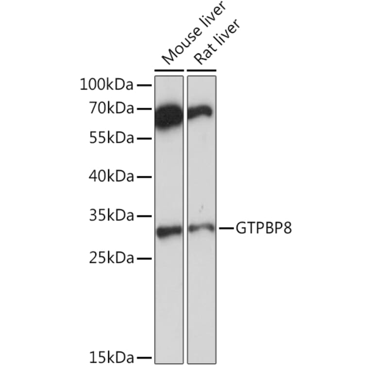 Western Blot - Anti-GTPBP8 Antibody (A91965) - Antibodies.com