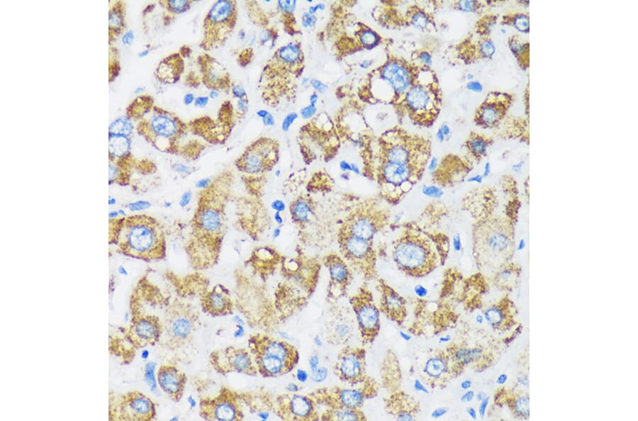 Immunohistochemistry - Anti-GTPBP8 Antibody (A91965) - Antibodies.com