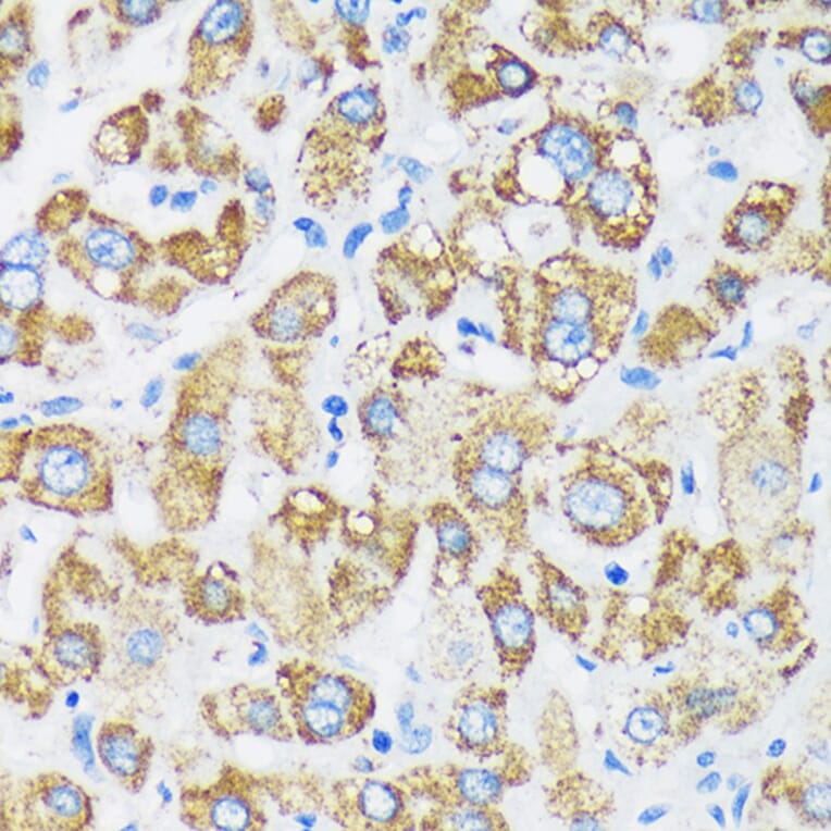 Immunohistochemistry - Anti-GTPBP8 Antibody (A91965) - Antibodies.com