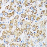 Immunohistochemistry - Anti-GTPBP8 Antibody (A91965) - Antibodies.com