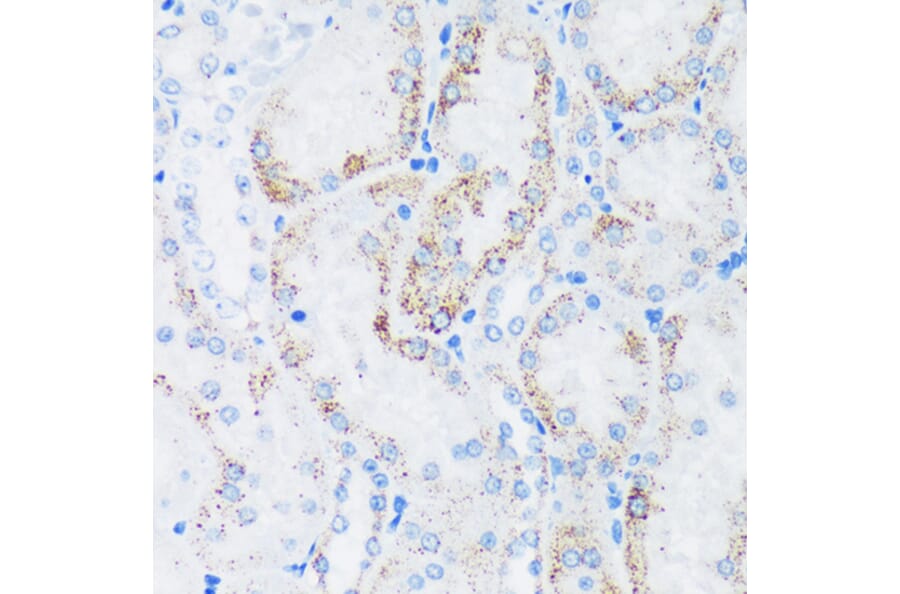 Immunohistochemistry - Anti-GTPBP8 Antibody (A91965) - Antibodies.com