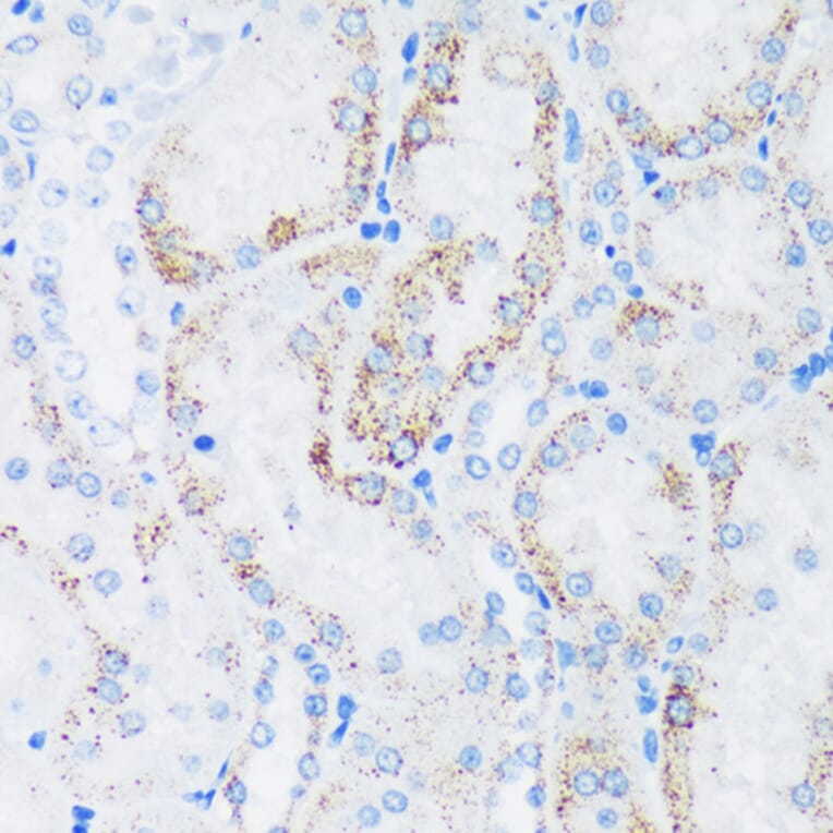 Immunohistochemistry - Anti-GTPBP8 Antibody (A91965) - Antibodies.com
