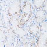 Immunohistochemistry - Anti-GTPBP8 Antibody (A91965) - Antibodies.com