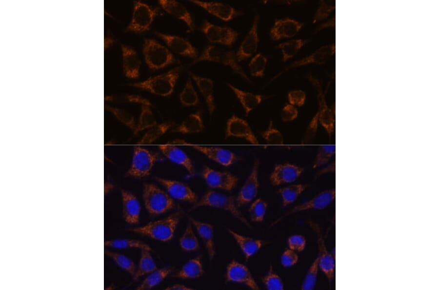 Immunofluorescence - Anti-GTPBP8 Antibody (A91965) - Antibodies.com