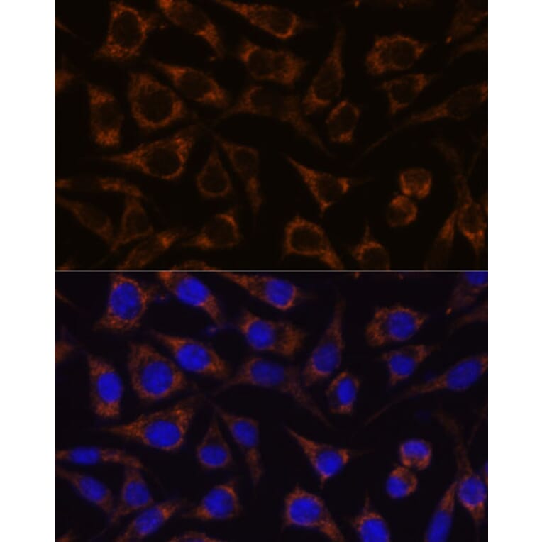 Immunofluorescence - Anti-GTPBP8 Antibody (A91965) - Antibodies.com