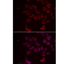 Immunofluorescence - Anti-RPL11 Antibody (A91966) - Antibodies.com