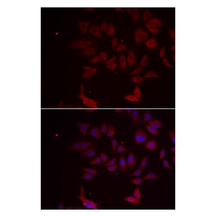 Immunofluorescence - Anti-RPL11 Antibody (A91966) - Antibodies.com