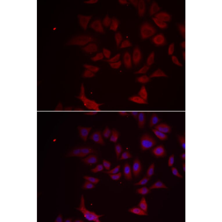 Immunofluorescence - Anti-RPL11 Antibody (A91966) - Antibodies.com