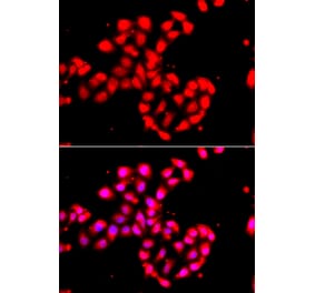 Immunofluorescence - Anti-CAMK1D Antibody (A91971) - Antibodies.com