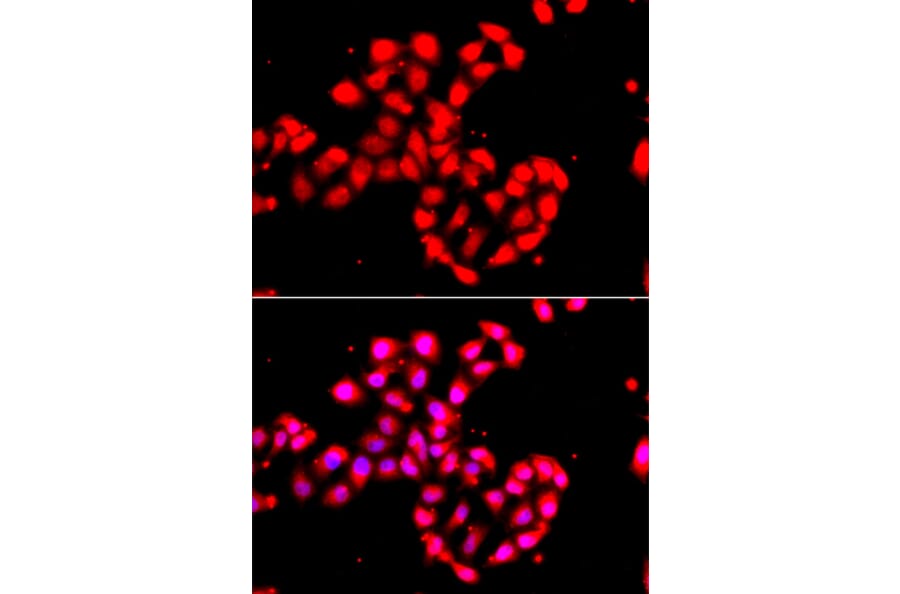 Immunofluorescence - Anti-CAMK1D Antibody (A91971) - Antibodies.com