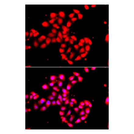 Immunofluorescence - Anti-CAMK1D Antibody (A91971) - Antibodies.com