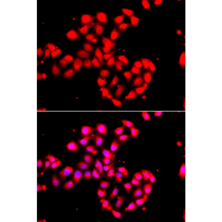 Immunofluorescence - Anti-CAMK1D Antibody (A91971) - Antibodies.com