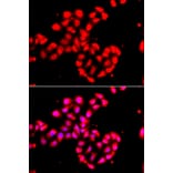 Immunofluorescence - Anti-CAMK1D Antibody (A91971) - Antibodies.com