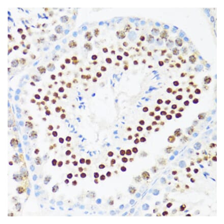 Immunohistochemistry - Anti-DDX21 Antibody (A91973) - Antibodies.com