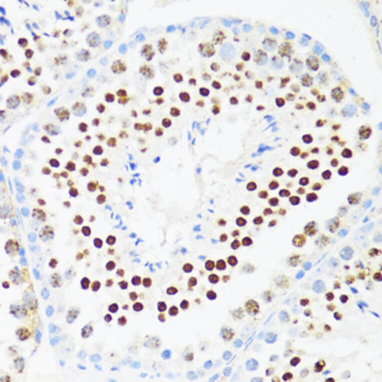Immunohistochemistry - Anti-DDX21 Antibody (A91973) - Antibodies.com
