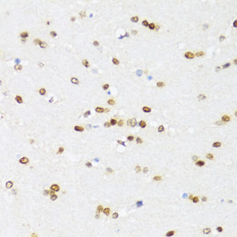 Immunohistochemistry - Anti-DDX21 Antibody (A91973) - Antibodies.com