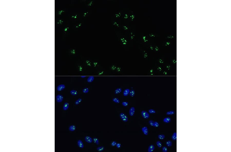Immunofluorescence - Anti-DDX21 Antibody (A91973) - Antibodies.com