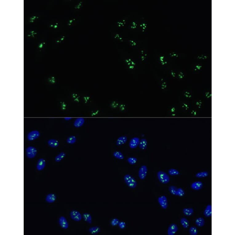 Immunofluorescence - Anti-DDX21 Antibody (A91973) - Antibodies.com
