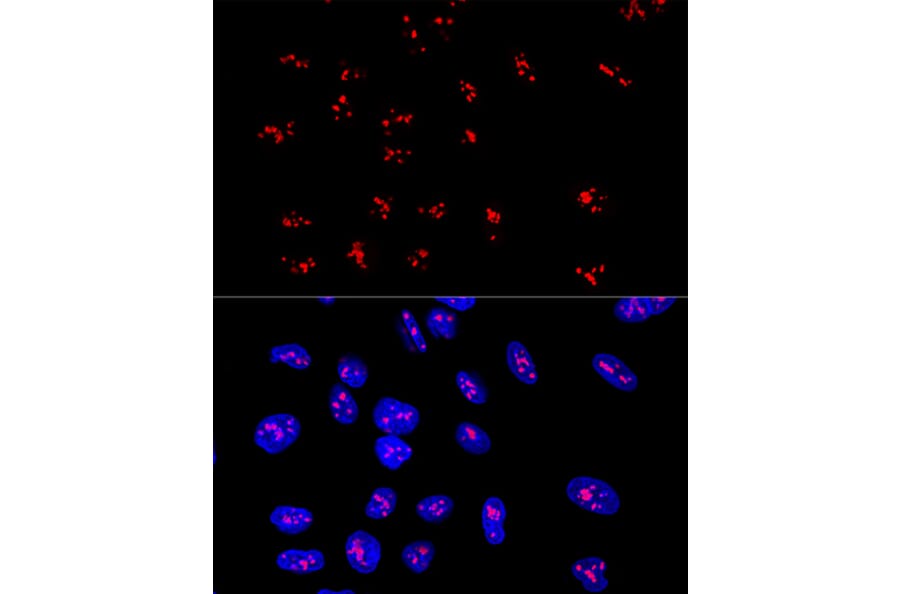 Immunofluorescence - Anti-DDX21 Antibody (A91973) - Antibodies.com