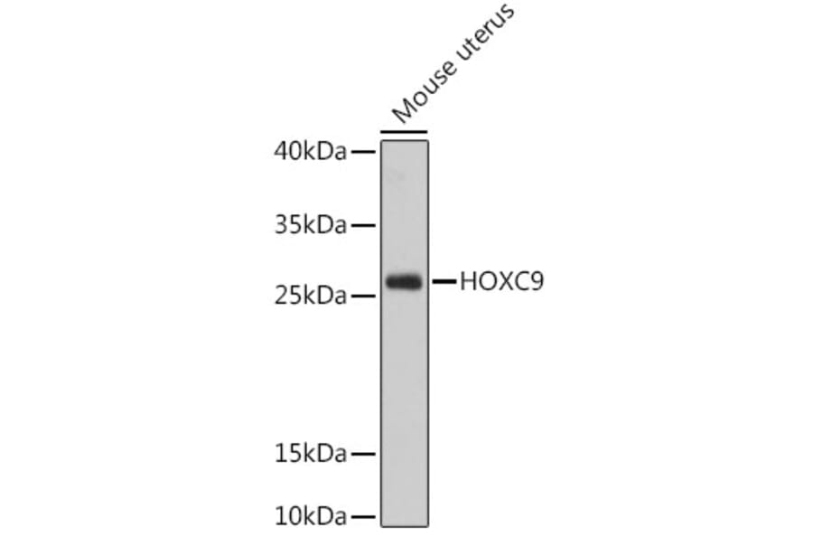 Western Blot - Anti-HOXC9 Antibody (A91974) - Antibodies.com