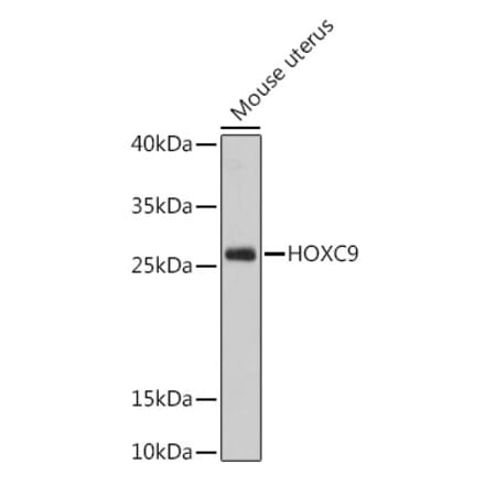 Western Blot - Anti-HOXC9 Antibody (A91974) - Antibodies.com