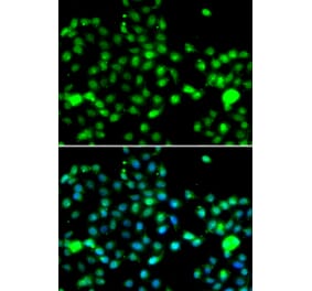 Immunofluorescence - Anti-IP6K2 Antibody (A91975) - Antibodies.com