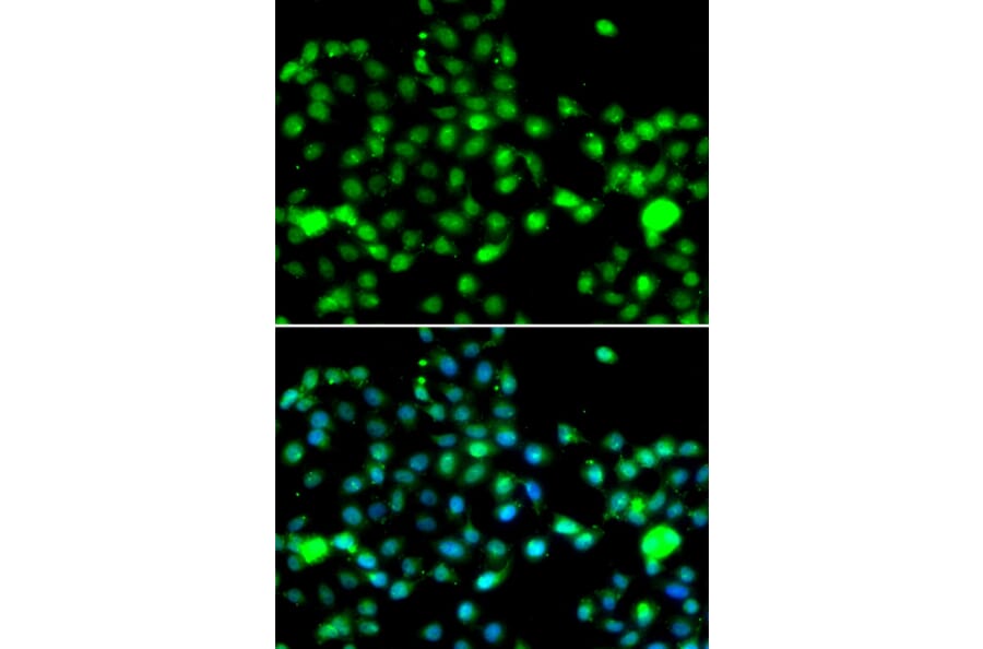 Immunofluorescence - Anti-IP6K2 Antibody (A91975) - Antibodies.com